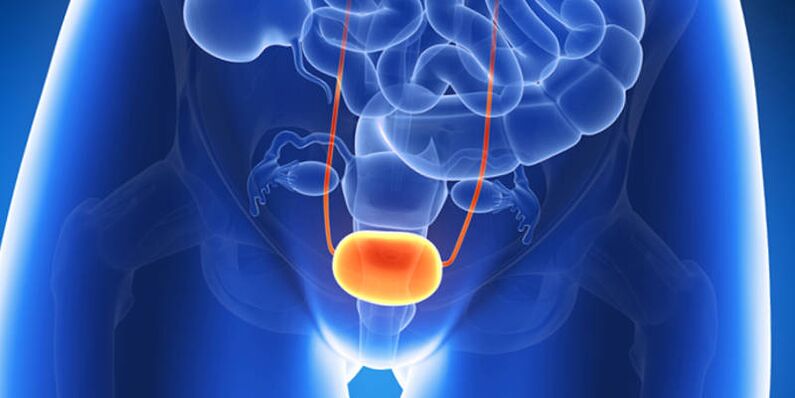 Treatment of bladder inflammation with tablets