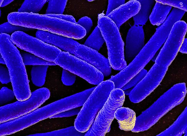 E. coli most often causes cystitis in women